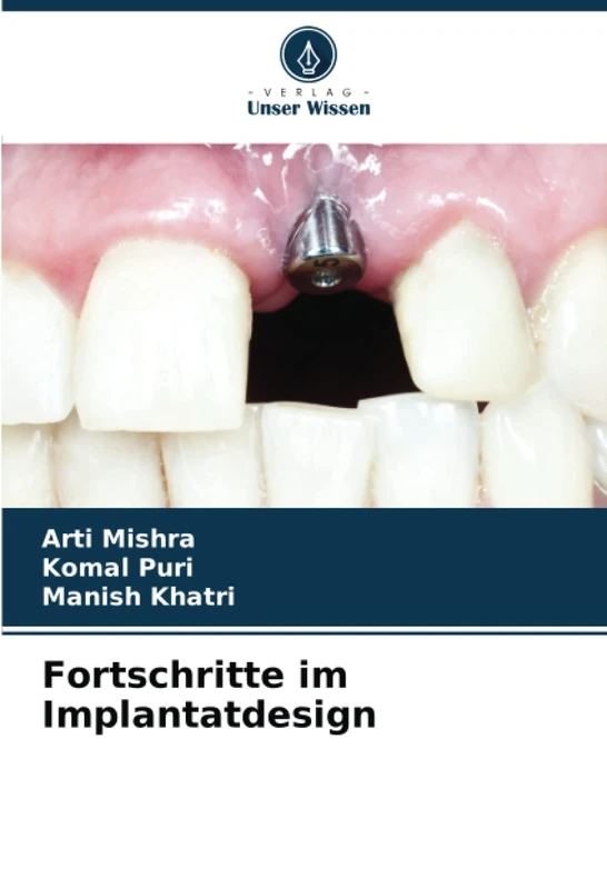 Fortschritte im Implantatdesign