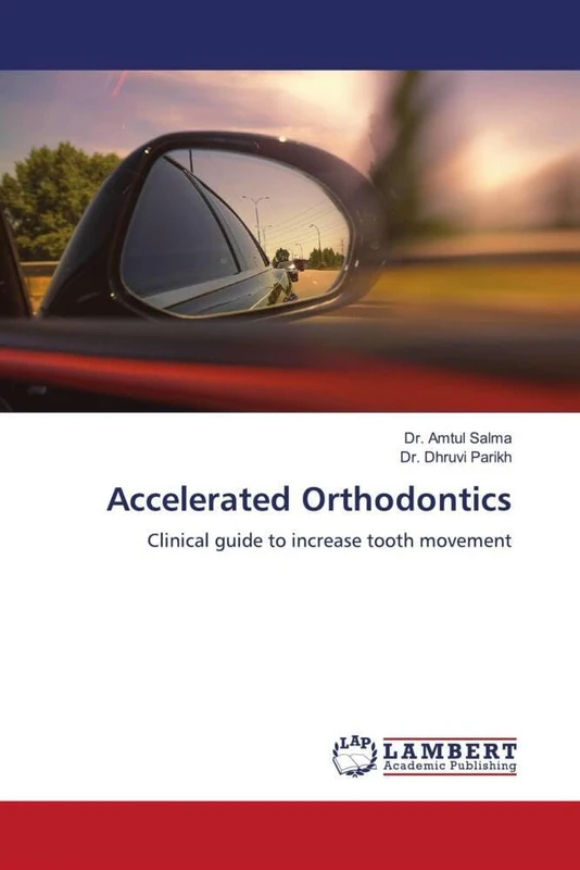 Accelerated Orthodontics: Clinical guide to increase tooth movement