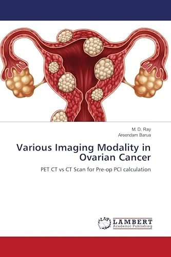 Various Imaging Modality in Ovarian Cancer: PET CT vs CT Scan for Pre-op PCI calculation