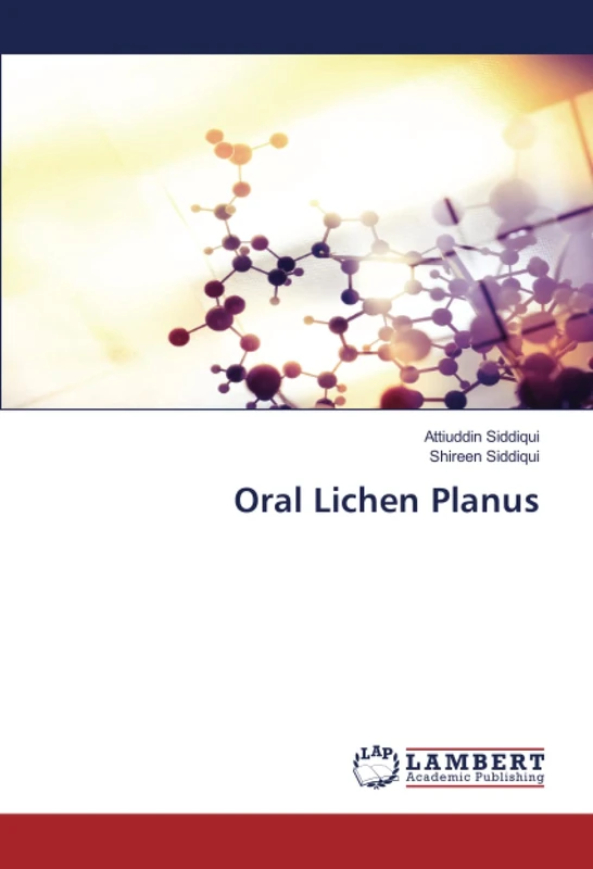 Oral Lichen Planus - Image 1