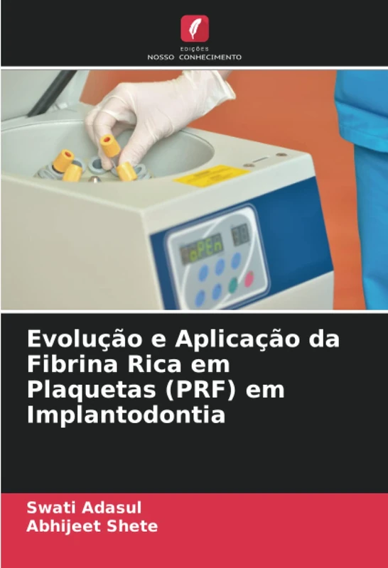 Evolução e Aplicação da Fibrina Rica em Plaquetas (PRF) em Implantodontia