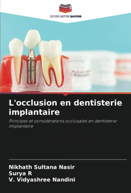 L'occlusion en dentisterie implantaire: Principes et considérations occlusales en dentisterie implantaire