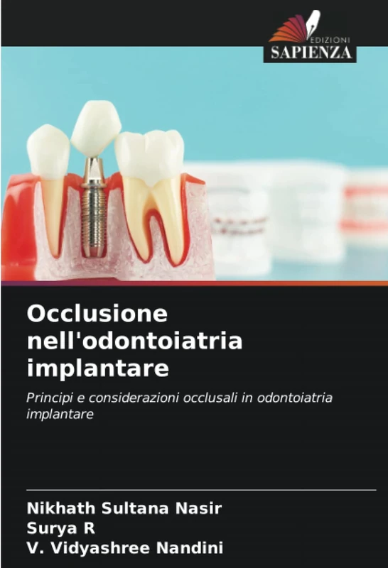 Occlusione nell'odontoiatria implantare: Principi e considerazioni occlusali in odontoiatria implantare