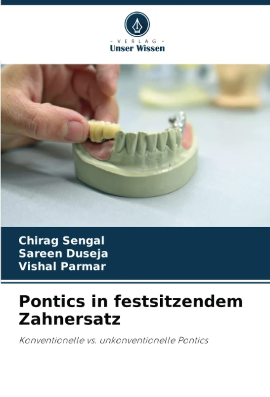 Pontics in festsitzendem Zahnersatz: Konventionelle vs. unkonventionelle Pontics