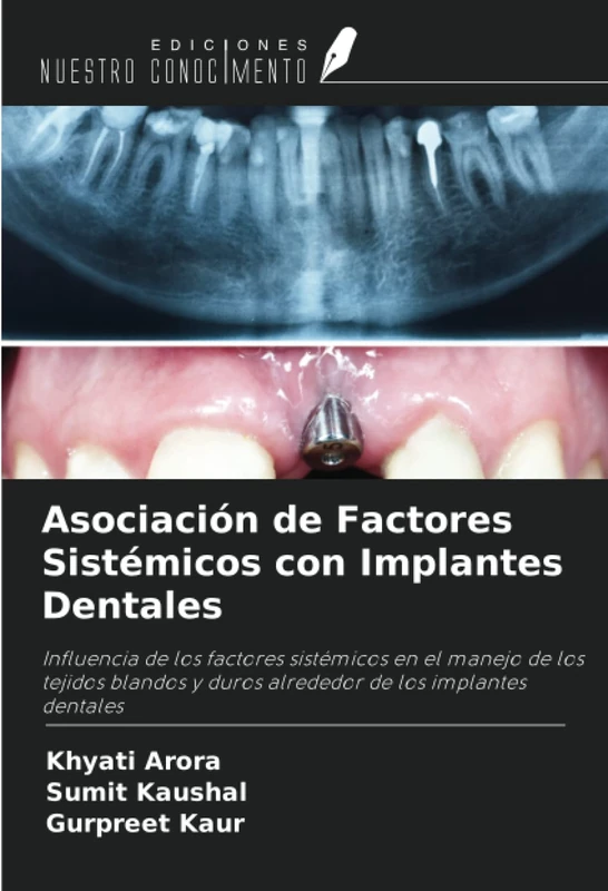 Asociación de Factores Sistémicos con Implantes Dentales: Influencia de los factores sistémicos en el manejo de los tejidos blandos y duros alrededor de los implantes dentales