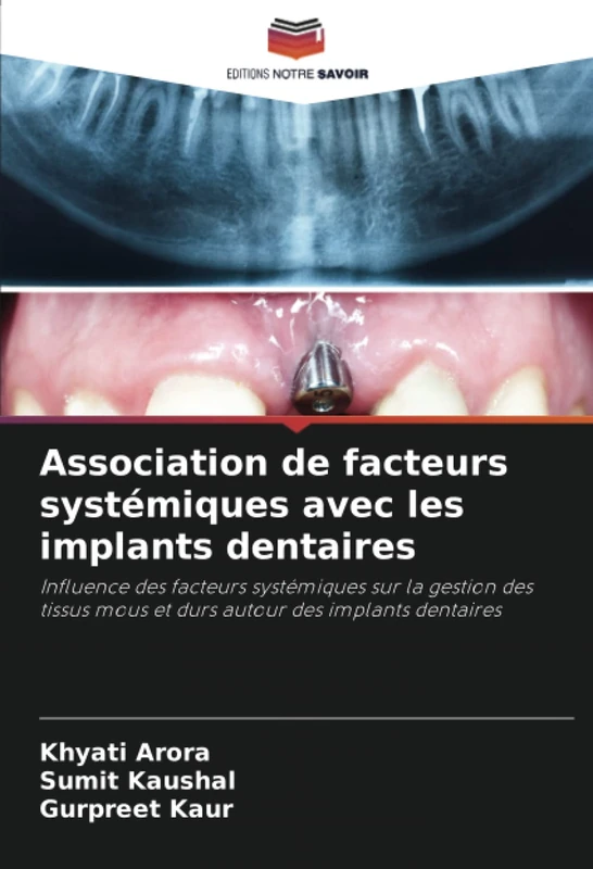 Association de facteurs systémiques avec les implants dentaires: Influence des facteurs systémiques sur la gestion des tissus mous et durs autour des implants dentaires - Image 1