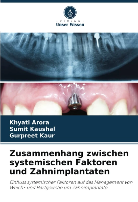 Zusammenhang zwischen systemischen Faktoren und Zahnimplantaten: Einfluss systemischer Faktoren auf das Management von Weich- und Hartgewebe um Zahnimplantate
