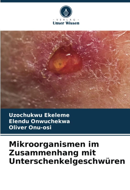 Mikroorganismen im Zusammenhang mit Unterschenkelgeschwüren