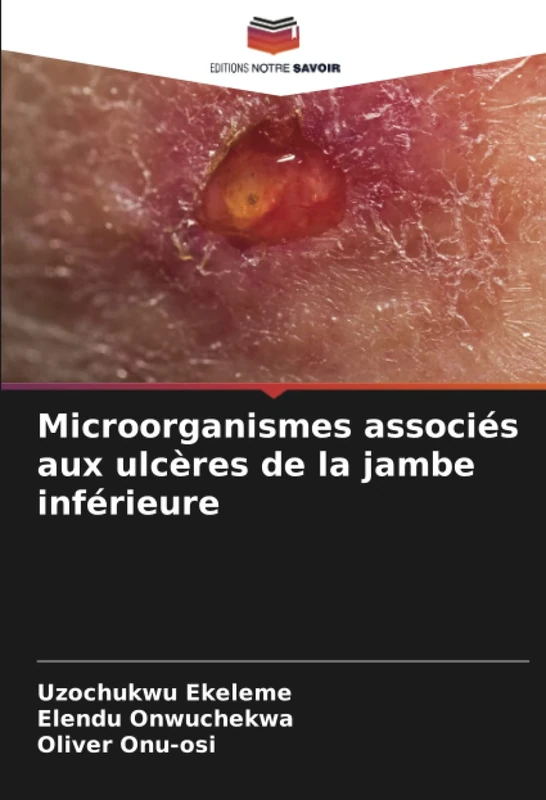 Microorganismes associés aux ulcères de la jambe inférieure - Image 1