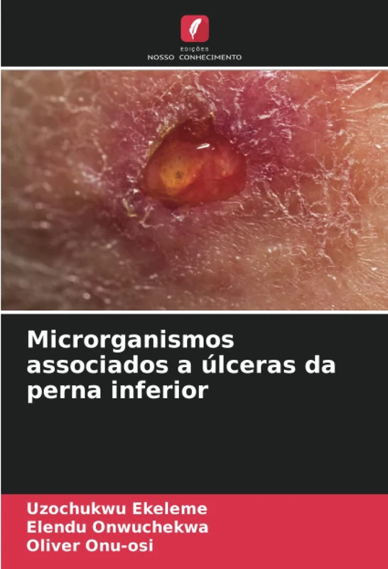 Microrganismos associados a úlceras da perna inferior