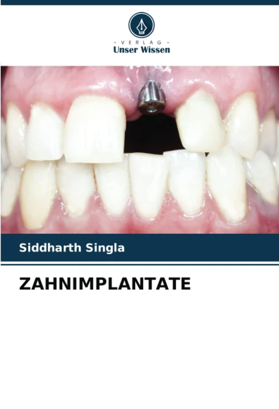ZAHNIMPLANTATE - Image 1