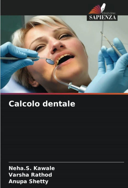 Calcolo dentale