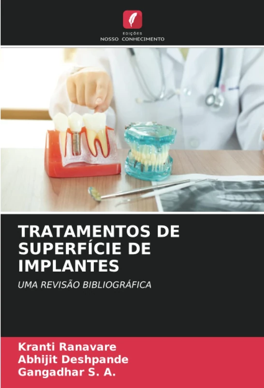 TRATAMENTOS DE SUPERFÍCIE DE IMPLANTES: UMA REVISÃO BIBLIOGRÁFICA
