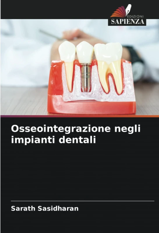 Osseointegrazione negli impianti dentali