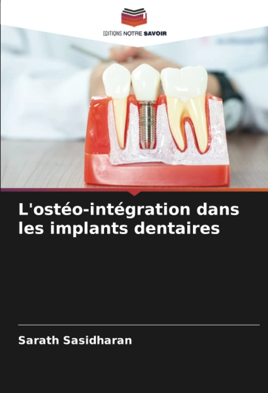 L'ostéo-intégration dans les implants dentaires
