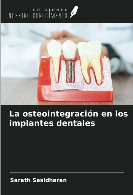 La osteointegración en los implantes dentales