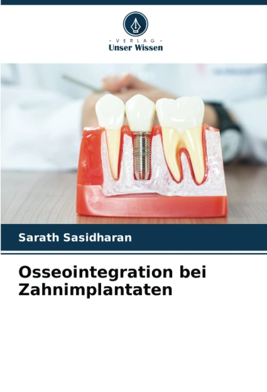 Osseointegration bei Zahnimplantaten