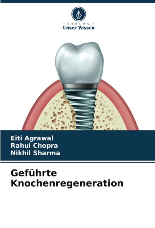 Geführte Knochenregeneration