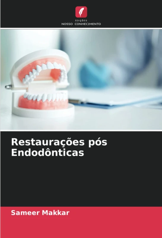Restaurações pós Endodônticas