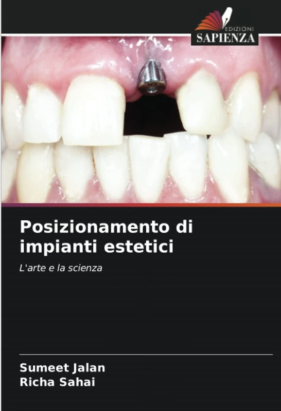 Posizionamento di impianti estetici: L'arte e la scienza