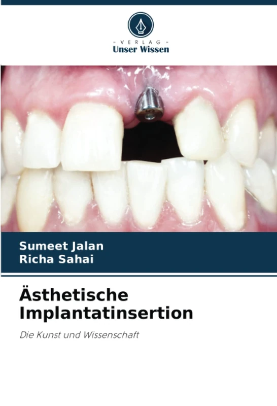 Ästhetische Implantatinsertion: Die Kunst und Wissenschaft