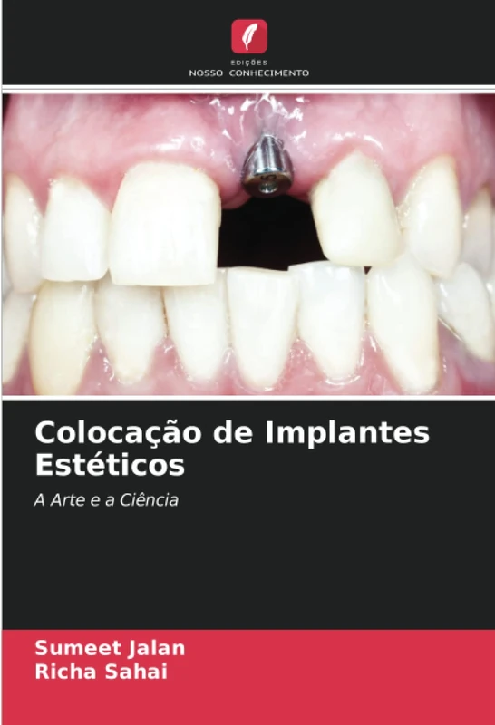 Colocação de Implantes Estéticos: A Arte e a Ciência