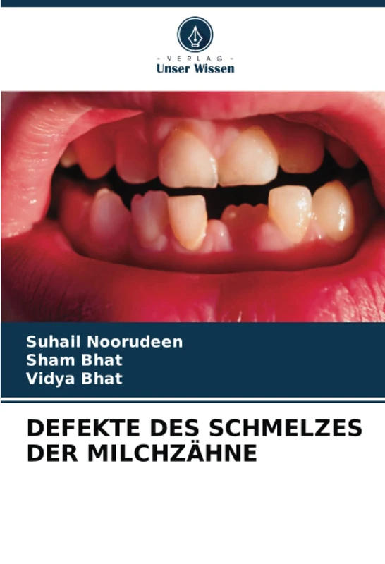 DEFEKTE DES SCHMELZES DER MILCHZÄHNE