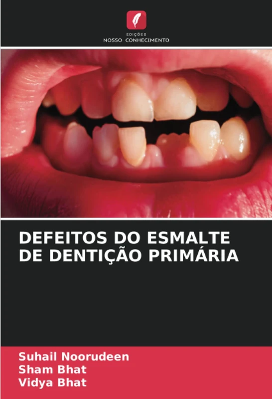 DEFEITOS DO ESMALTE DE DENTIÇÃO PRIMÁRIA