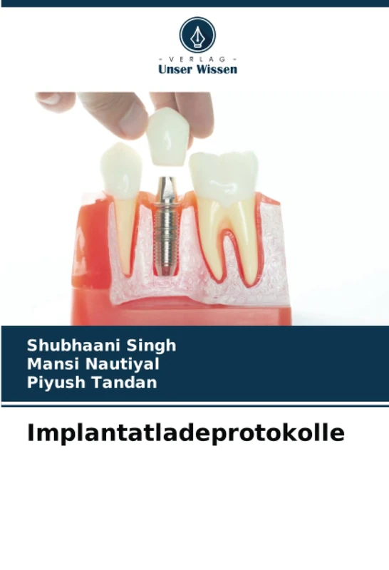 Implantatladeprotokolle