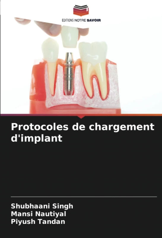 Protocoles de chargement d'implant
