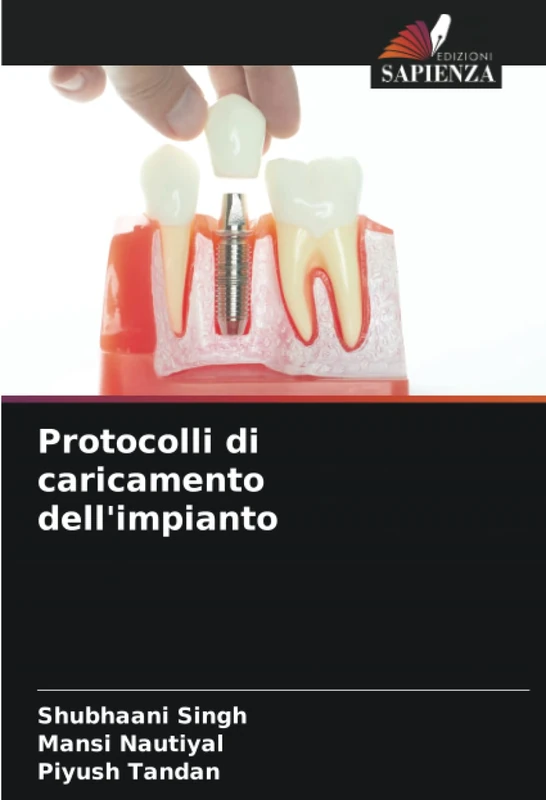 Protocolli di caricamento dell'impianto