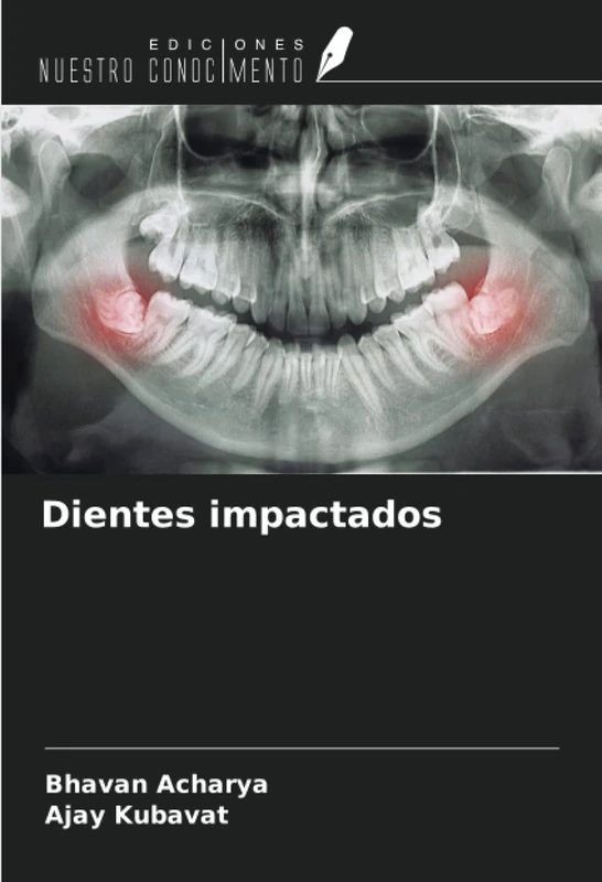 Dientes impactados