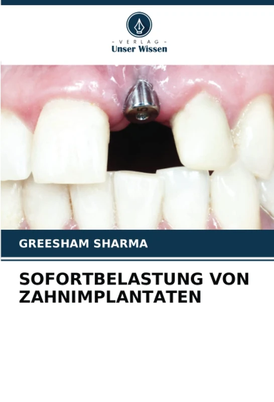 SOFORTBELASTUNG VON ZAHNIMPLANTATEN
