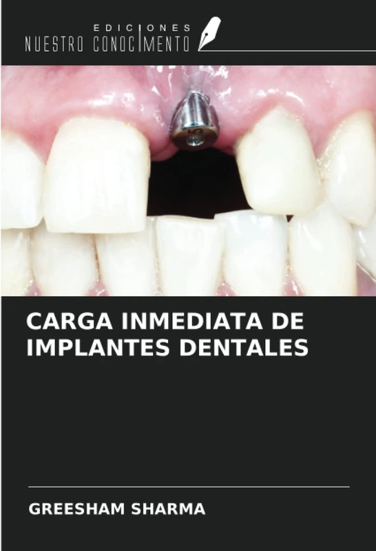 CARGA INMEDIATA DE IMPLANTES DENTALES
