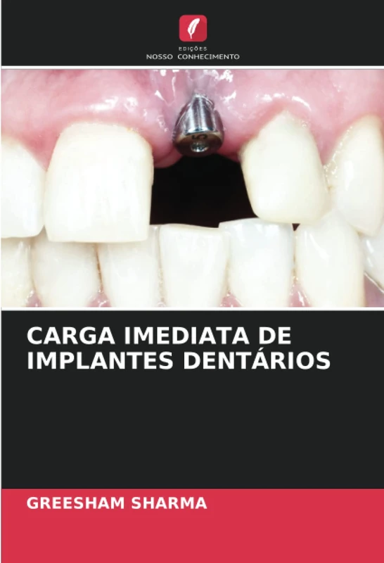 CARGA IMEDIATA DE IMPLANTES DENTÁRIOS - Image 1