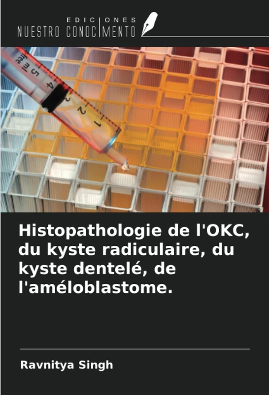 Histopathologie de l'OKC, du kyste radiculaire, du kyste dentelé, de l'améloblastome. - Image 1