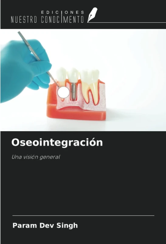 Oseointegración: Una visión general