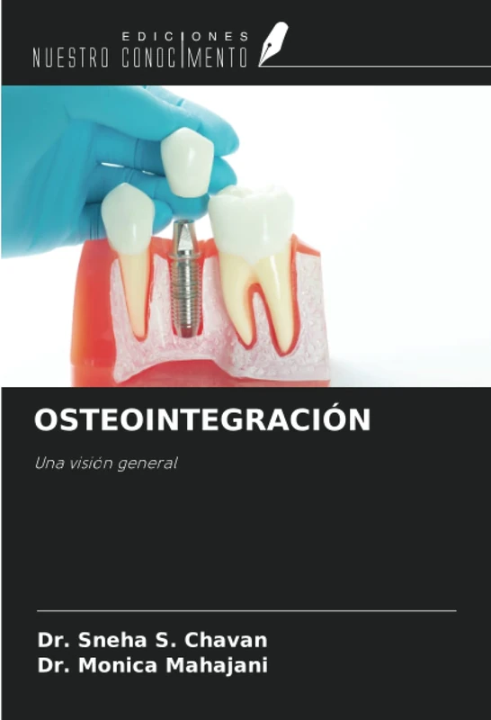 OSTEOINTEGRACIÓN: Una visión general - Image 1
