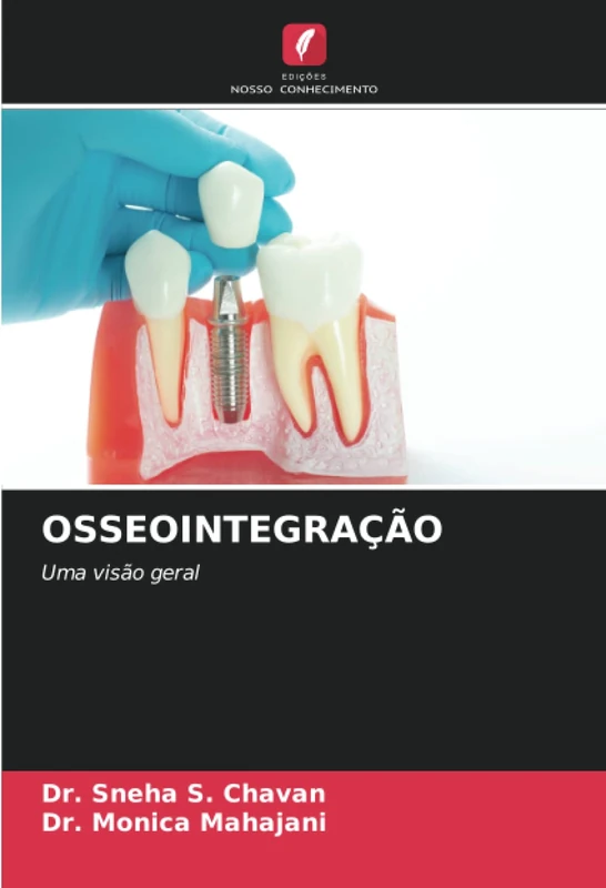 OSSEOINTEGRAÇÃO: Uma visão geral - Image 1