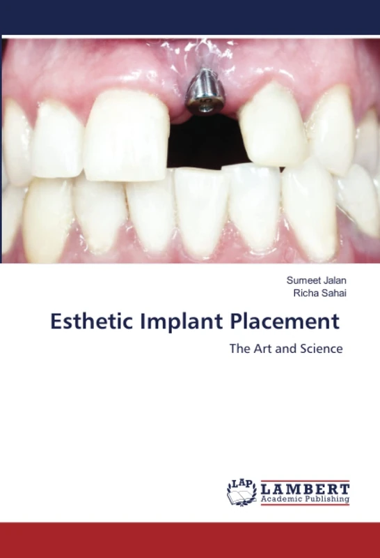 Esthetic Implant Placement: The Art and Science