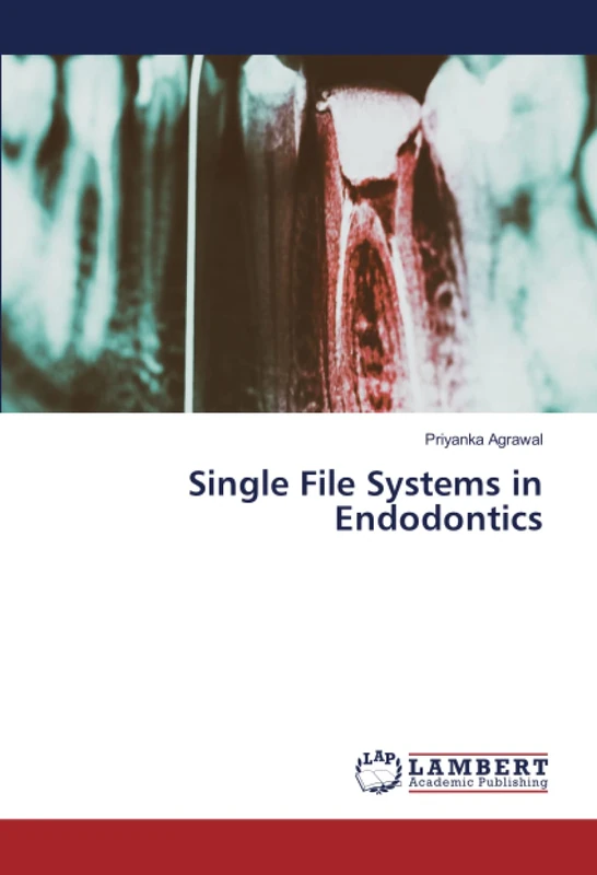 Single File Systems in Endodontics