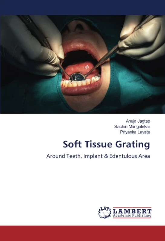 Soft Tissue Grating: Around Teeth, Implant & Edentulous Area