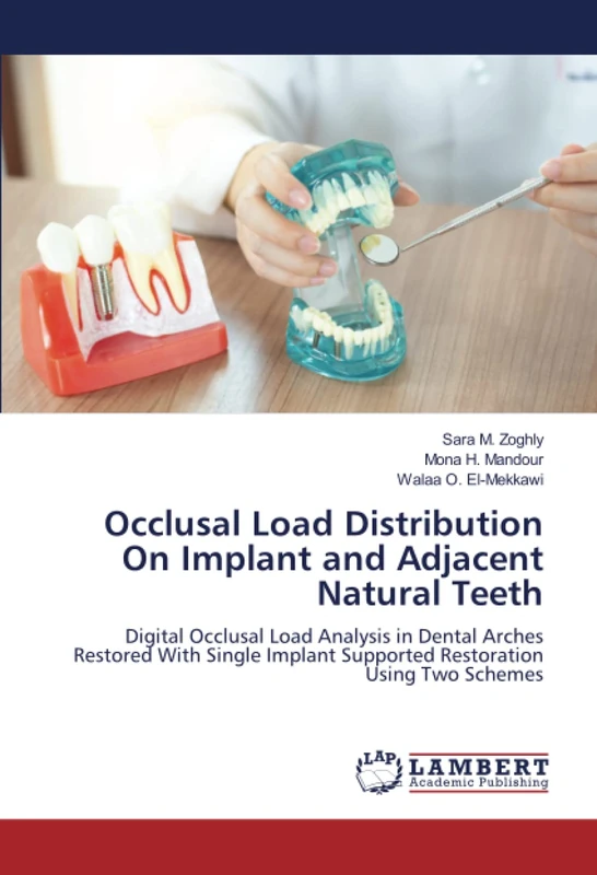 Occlusal Load Distribution On Implant and Adjacent Natural Teeth: Digital Occlusal Load Analysis in Dental Arches Restored With Single Implant Supported Restoration Using Two Schemes - Image 1