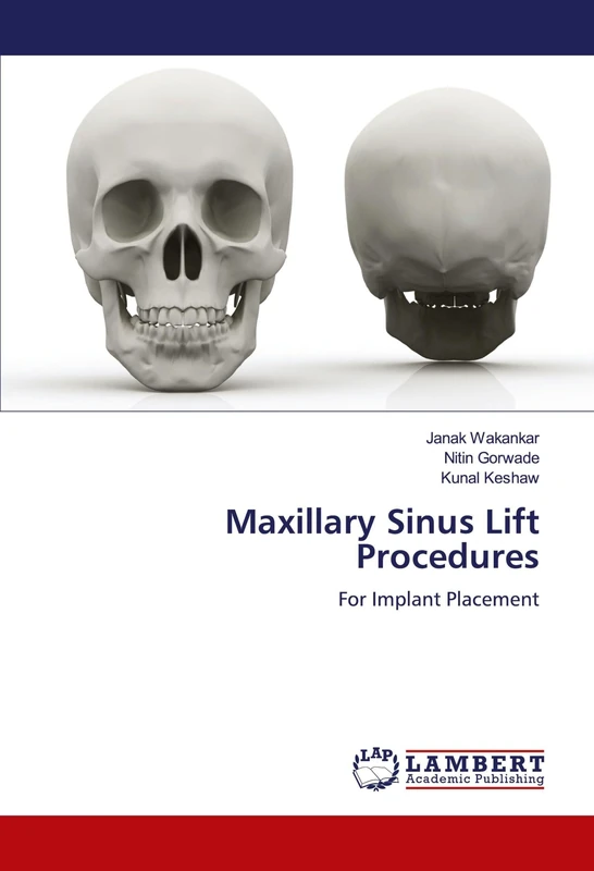 Maxillary Sinus Lift Procedures: For Implant Placement - Image 1