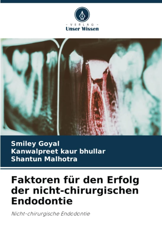 Faktoren für den Erfolg der nicht-chirurgischen Endodontie: Nicht-chirurgische Endodontie
