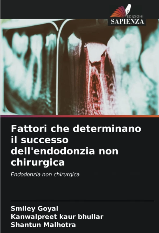 Fattori che determinano il successo dell'endodonzia non chirurgica: Endodonzia non chirurgica - Image 1