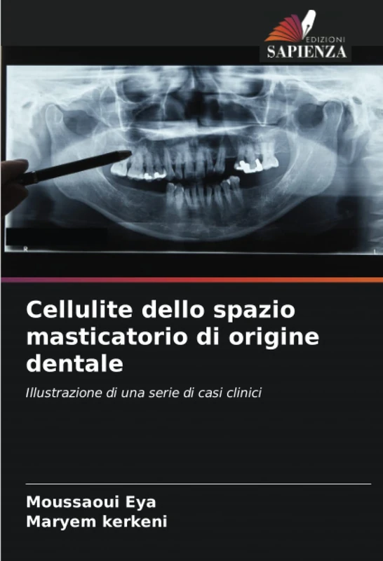 Cellulite dello spazio masticatorio di origine dentale: Illustrazione di una serie di casi clinici