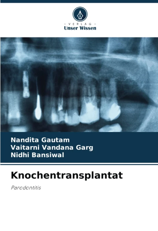 Knochentransplantat: Parodontitis