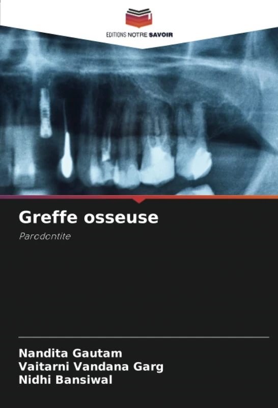 Greffe osseuse: Parodontite