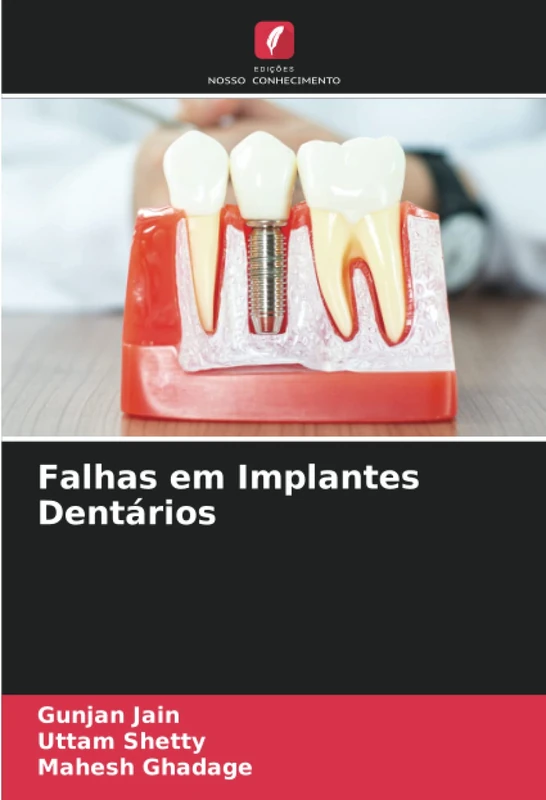 Falhas em Implantes Dentários